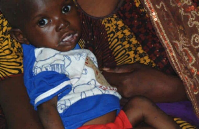Comprendre la malnutrition au Mali et ses enjeux majeurs